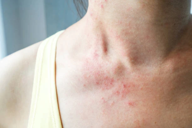 istockphoto-922607396-612x612 istockphoto-922607396-612x612