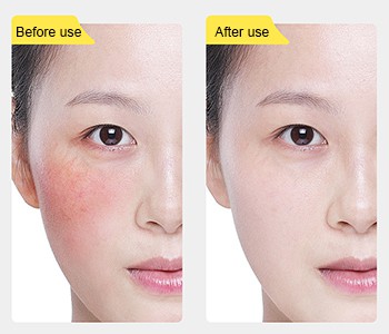 De 【sterkste helper】 van huidbarrière - ectoin