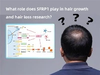 Welke rol speelt SFRP1 in onderzoek naar haargroei en haarverlies?